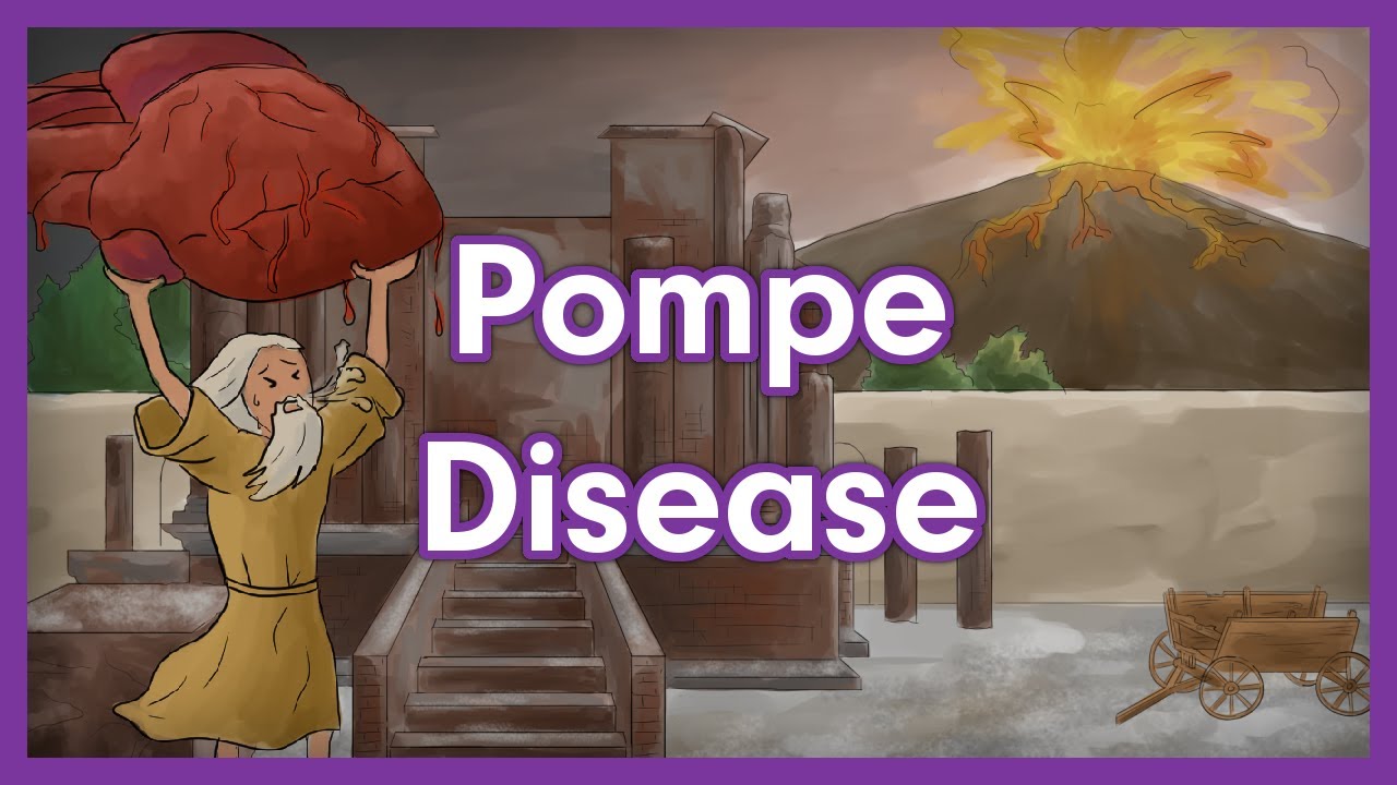 Download Pompe Disease | Glycogen Storage Disease Mnemonic for USMLE