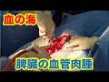 脾臓の血管肉腫　血腹