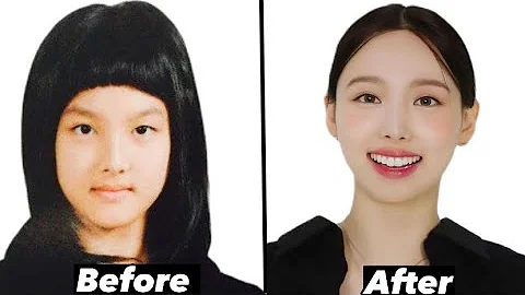 Twice Nayeon EXTREME plastic surgery