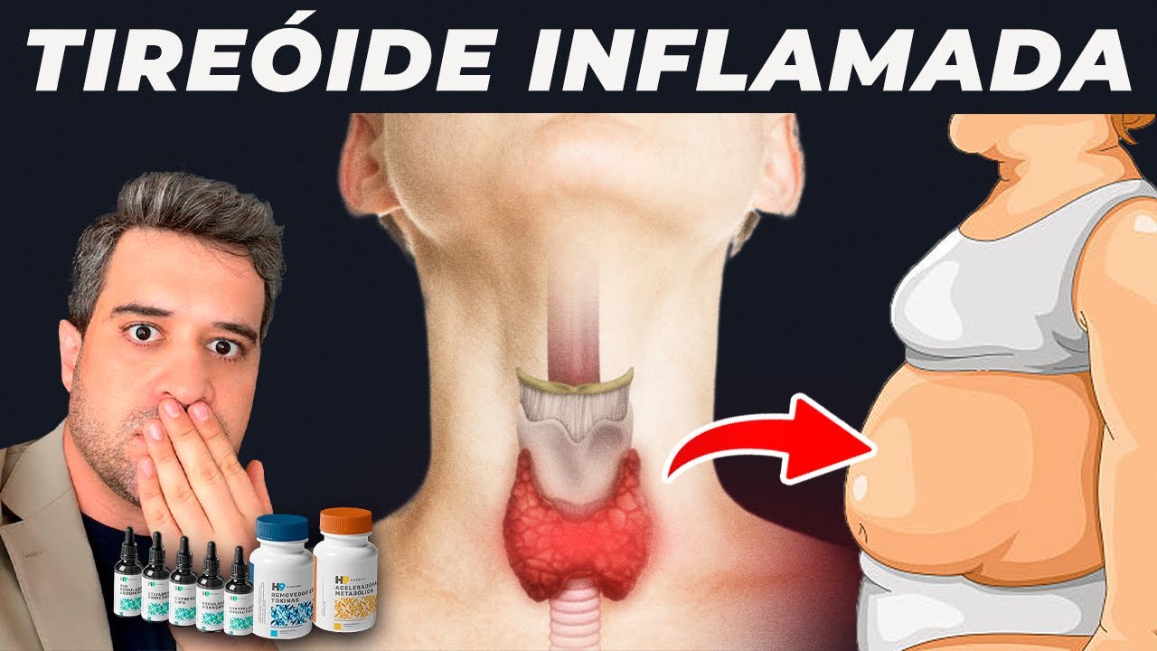 Á MELHOR FORMA DE REGULAR SUA TIREÓIDE - YouTube