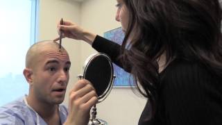 Clinicana Hair Transplant