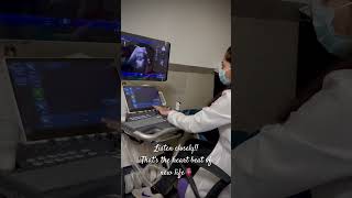 Heard fetal heart sound for the first time by M mode of USG. Normal baseline FHR:110-160 bpm.