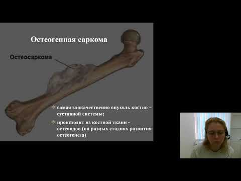 Онкология. Злокачественные опухоли костей