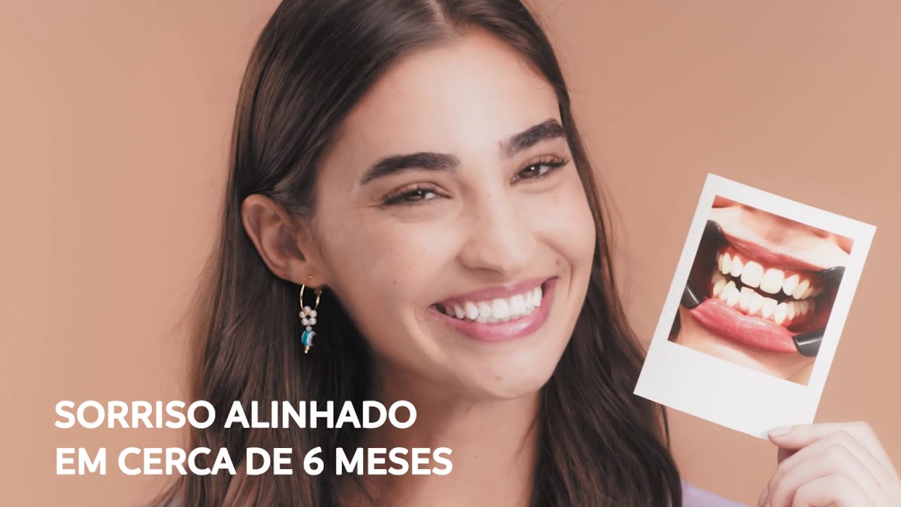 Aparelho Invisível SouSmile - Moderno e transparente