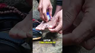 How to Remove Leech Bites in the Mountains #leeches #mountains #mountainleeches #survival #hiking