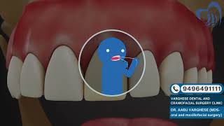 Post Operation Instructions with Temporary Crowns
