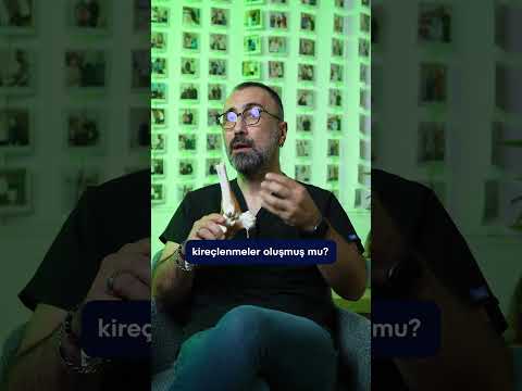 AŞİL TENDON İLTİHABI OLDUĞUNU NASIL ANLARIZ? / PROF. DR. UMUT YAVUZ