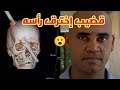 الرجل الذي اخترق القضيب رأسه لكن لا يزال حيا الرجل الذي اخترق القضيب رأسه لكن لا يزال حيا