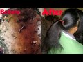 2 Ingredients For Fastest Hair Growth At Home Naturally / Julia Beauty