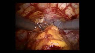 RARP Full case (with Commentary) Alastair Lamb Oxford