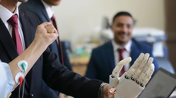 Prosthetic hand Prototype