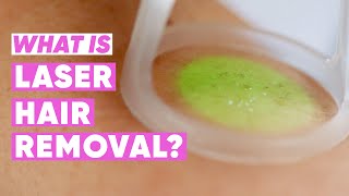 Laser hair removal – what is it | 