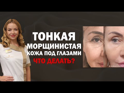 ТОНКАЯ КОЖА ПОД ГЛАЗАМИ ⁉️ ‍ МОРЩИНЫ ПОД ГЛАЗАМИ ЧТО ДЕЛАТЬ - YouTube