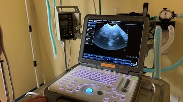 How to capture still images and video with ultrasound