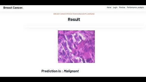 Breast Cancer Classification using CNN with Transfer Learning Models | Machine Learning IEEE Project