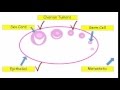 12DaysinMarch, Ovarian Tumors for USMLE Step One