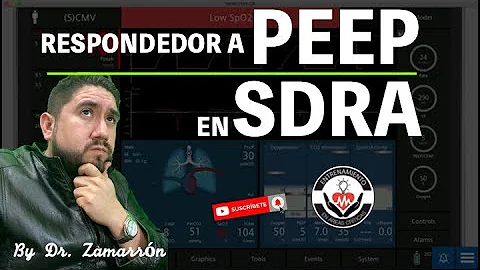 Como fazer o cálculo da PEEP ideal?