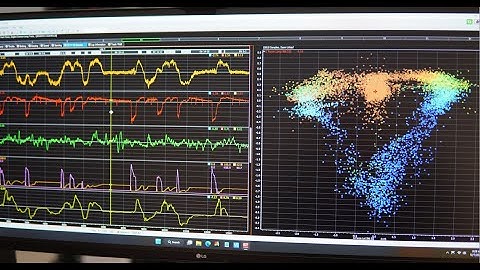 Why Race Car Drivers Need Data Acquisition (and How You Can Benefit)