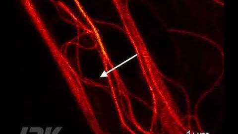 Correlative AFM and STED – Rupture of microtubules in real-time