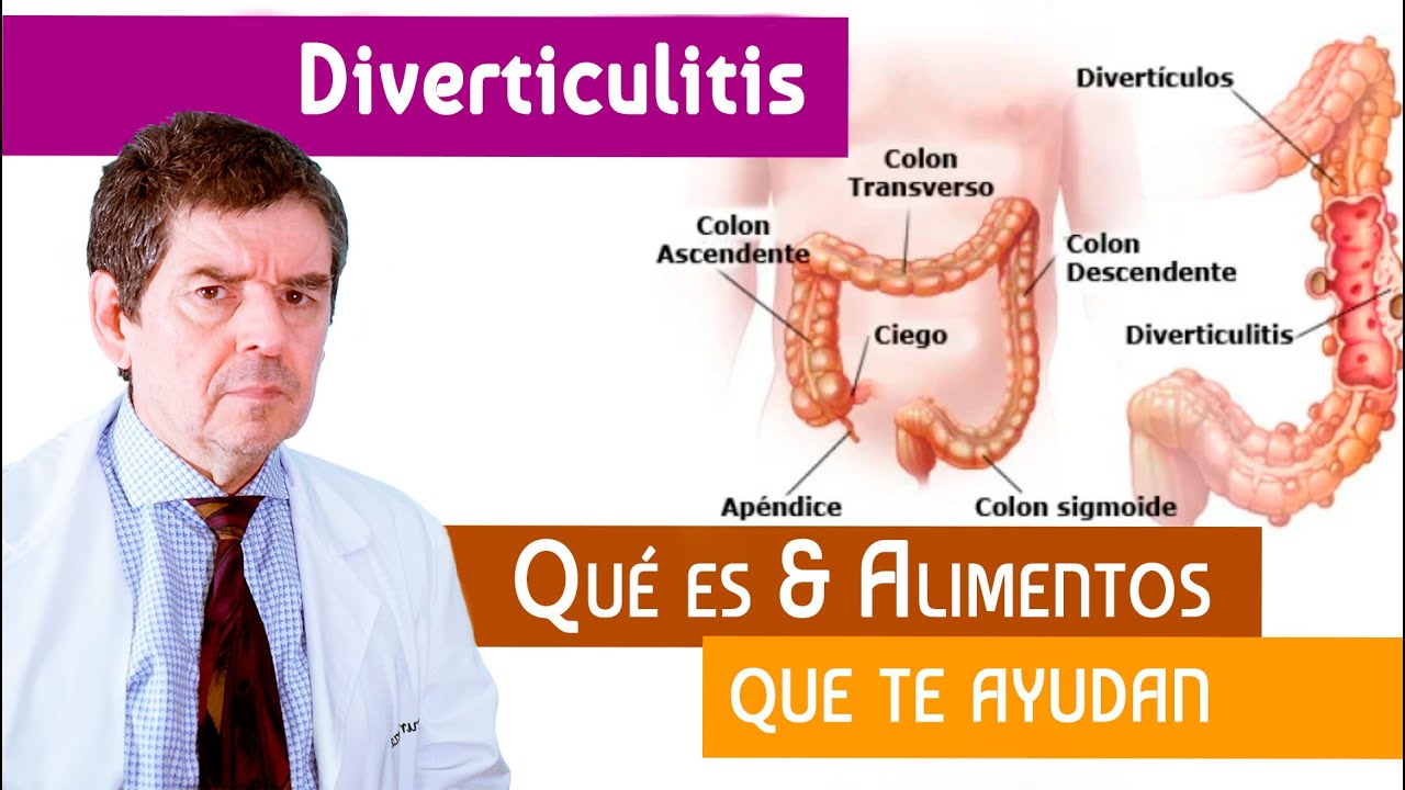 Diverticulitis y ansiedad