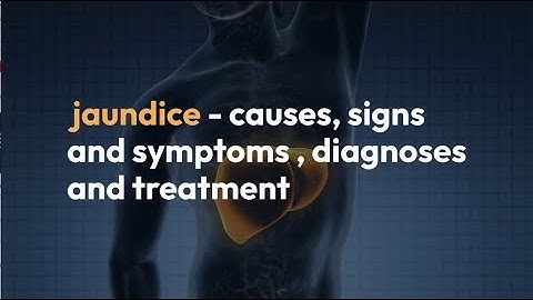 jaundice - causes, signs and symptoms , diagnoses  and treatment