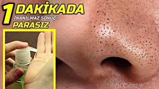 Evinizdeki Sıvı Sabuna Bunları Koyun 1 Daki̇kada Si̇yah Noktalarinizdan Kurtulun Güzellik Bakım