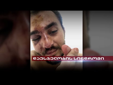 თვეზე მეტი გავიდა რუსული კანონის მოწინააღმდეგეებზე მომხდარი თავდასხმებიდან