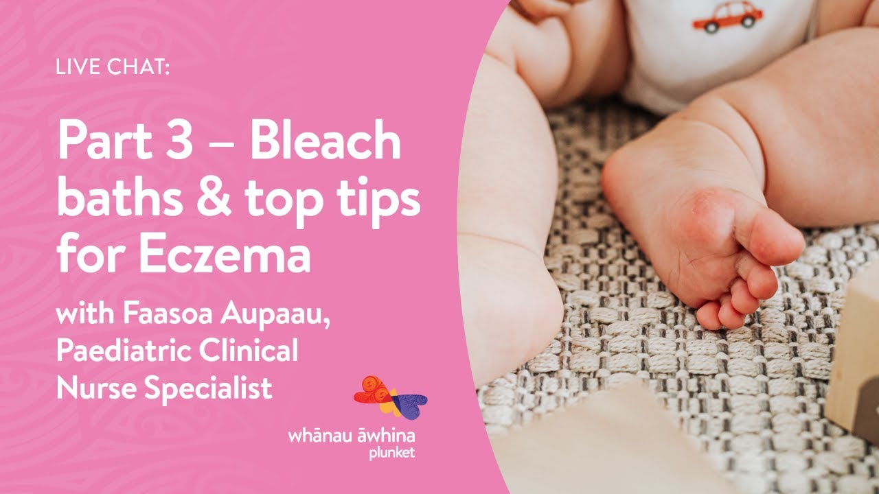Skin Series Part 3 Bleach baths & top tips for Eczema YouTube