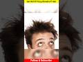 Get Rid Of Frizzy/Dandruff Hair | #shorts