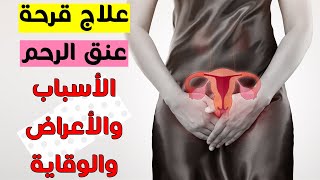 علاج قرحة عنق الرحم ( اعراض قرحة عنق الرحم واسبابها وطرق الوقاية منها )