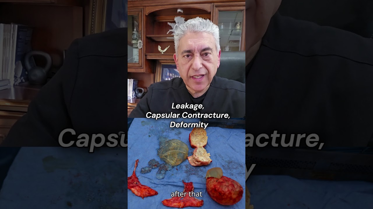 Old Silicone Breast Implants 