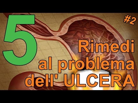 Video: 4 semplici modi per prevenire le ulcere della bocca