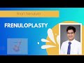 Understanding Frenuloplasty: Procedure, Benefits, and Recovery