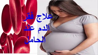 علاج فقر الدم أو الأنيميا عند الحامل