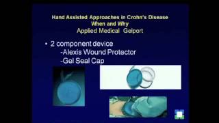Hand Assisted Approaches in Crohn�s Disease: Eric G. Weiss, M.D.