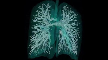 Automatic vessels segmentation