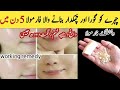 Besan & Banana Facepack For Glowing Skin || Besan Facepack For Glow || Winter Facepack For Glow