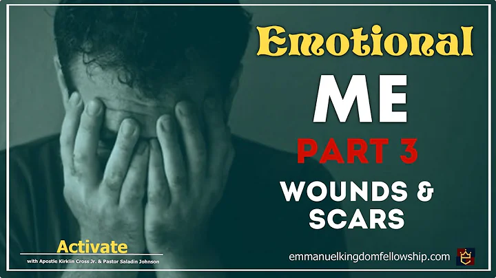 Emotional Me: Wounds & Scars - Apostle Kirklin Cro...