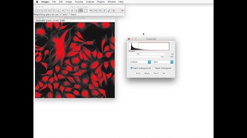 FIJI for Quantification: Cell Confluency