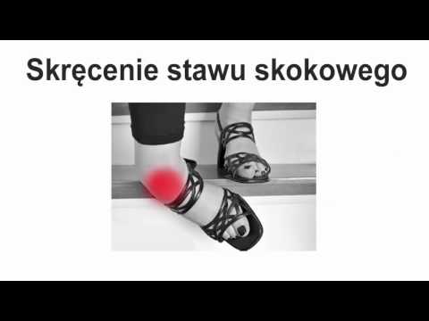 Wideo: Wysokie Zwichnięcie Kostki: Objawy, Leczenie I Powrót Do Zdrowia