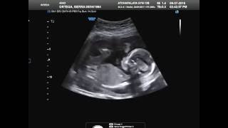 Baby girl's ultrasound at 19 weeks