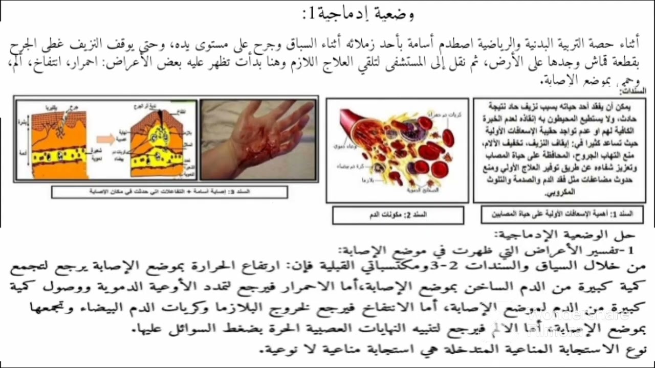 وضعية إدماجية حول المناعة التفاعل الالتهابي