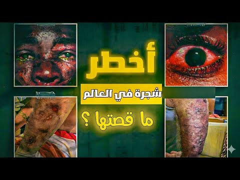 أخطر شجرة في العالم ودخلت موسوعة غينيس لشدة خطورتها شجرة المانشينيل