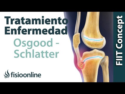 Video: Cómo reducir el dolor de la enfermedad de Osgood Schlatters: 11 pasos
