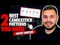 THE BEST Candlestick Patterns YOU NEED... (Powerful Setups)