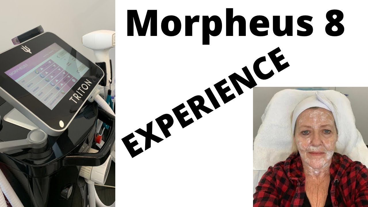 My Morpheus8  experience