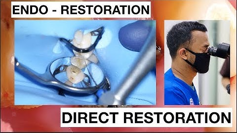 Step by step Endodontic Restoration Composite Premolar | General Dentist Griya RR
