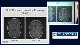 Introducing MRI: Inversion Recovery (35 of 56)