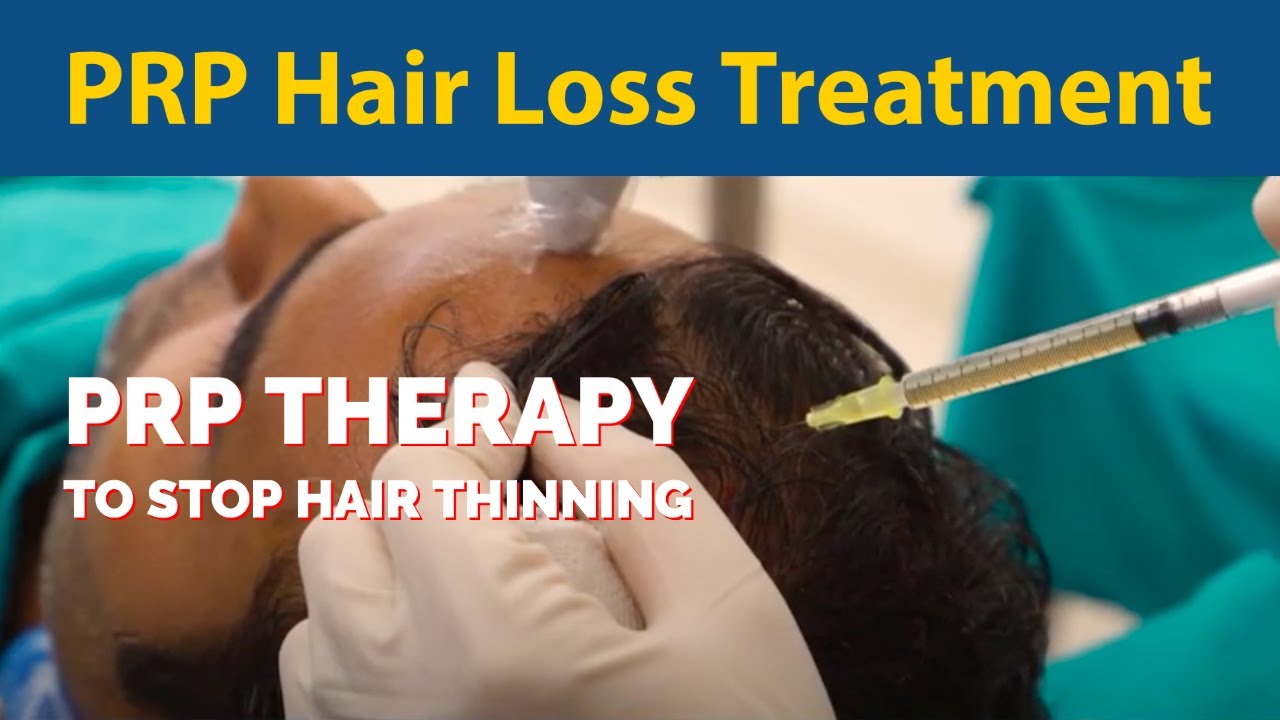 PRP Hair Loss Treatment PRP Therapy to stop hair thinning (Platelet