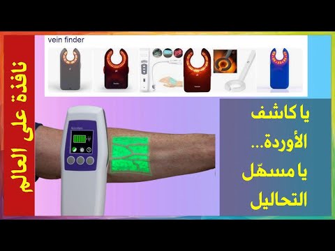جهاز كاشف الأوردة العجيب